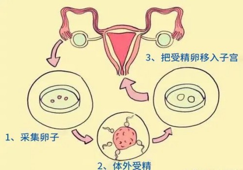 成都供卵助孕费用公开，附每个流程价格明细